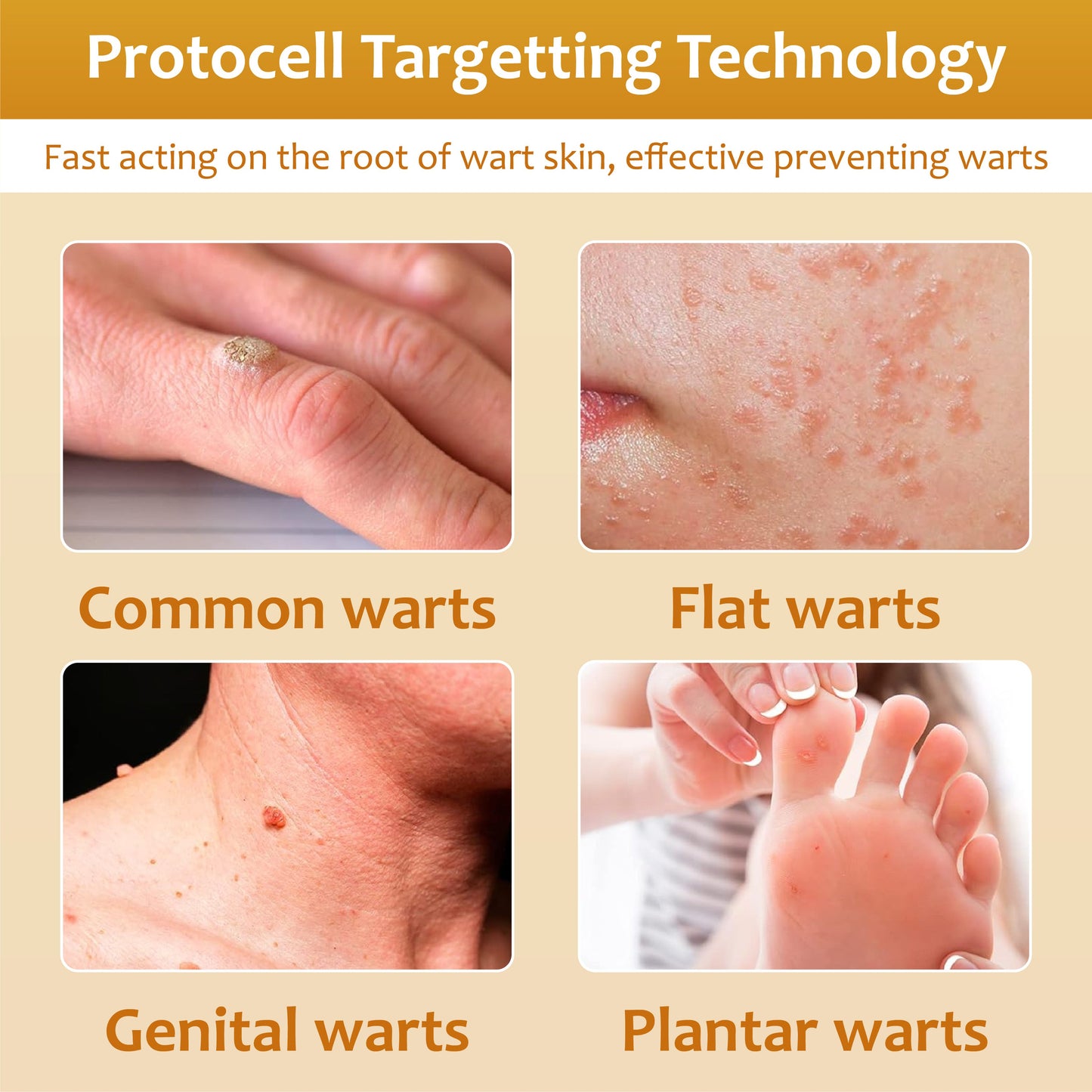 ClearSkin Bee Venom Wart and Tags Removal Spray 2