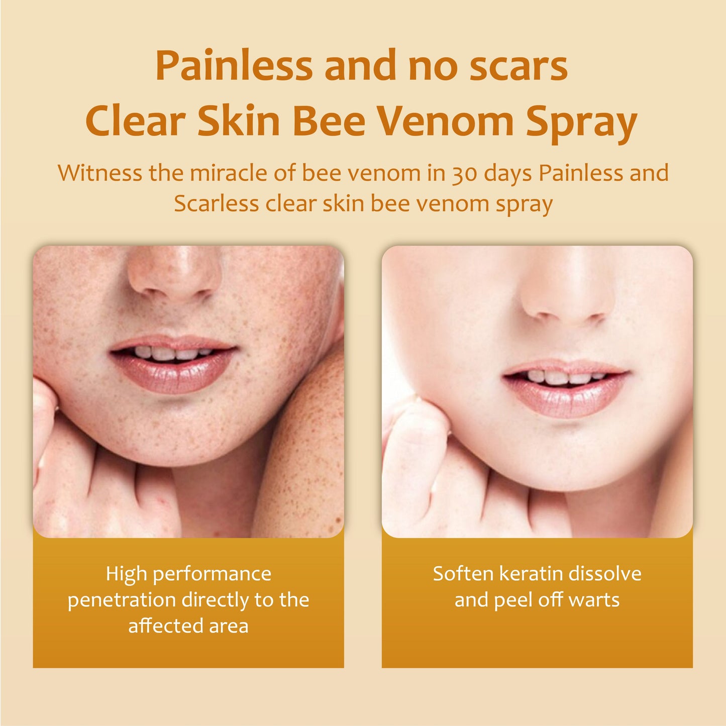 ClearSkin Bee Venom Wart and Tags Removal Spray 2
