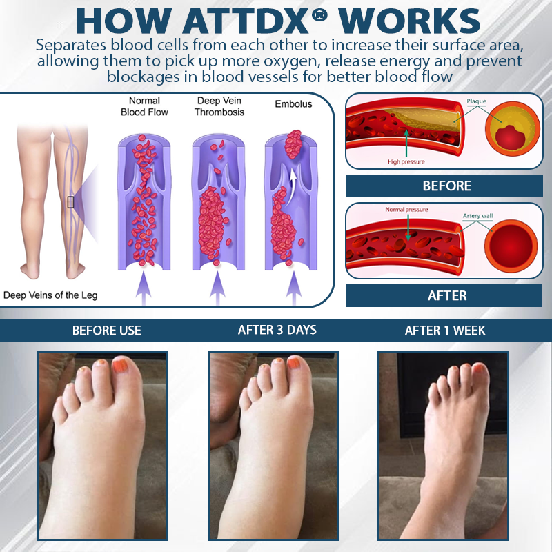 ATTDX® Black Cumin Edema Soothing Herbal Cream