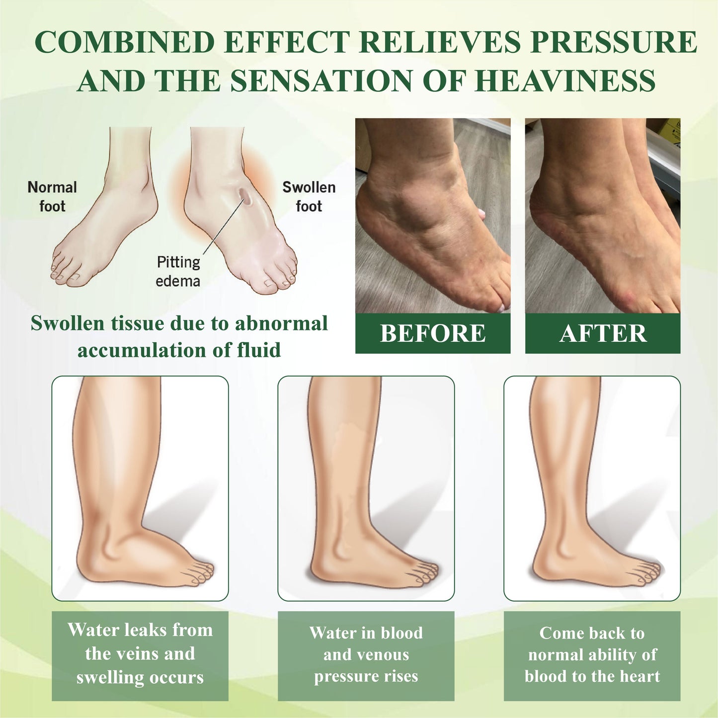 ATTDX® PuffyGone Horse Chestnut Edema Cream