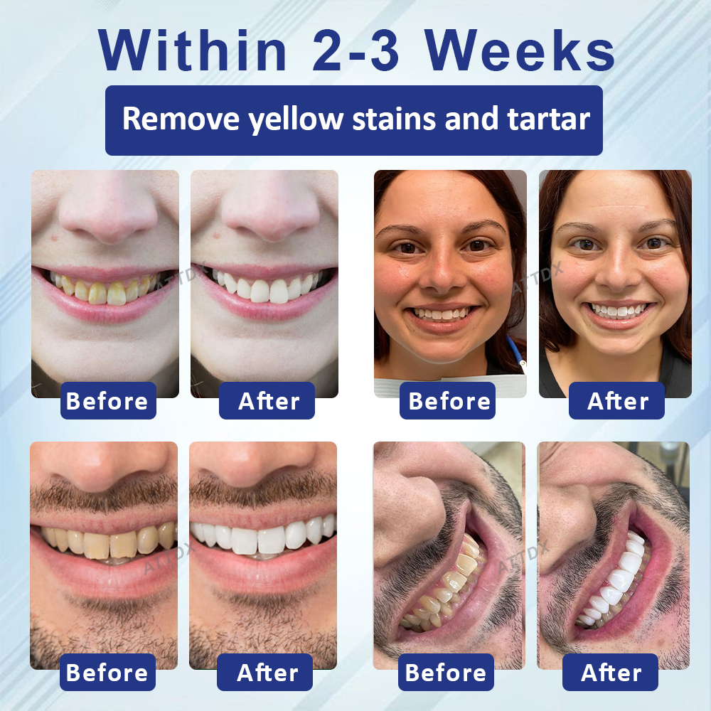 ATTDX™ Concentrated Mellifera Venom Mouth Care Toothpaste