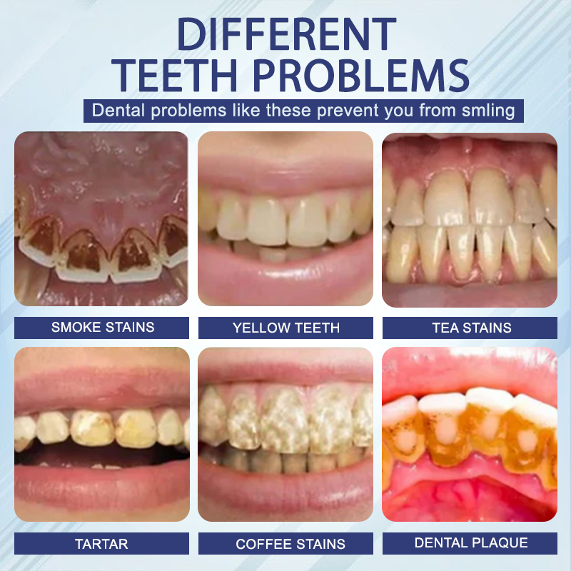 ATTDX™ Concentrated Mellifera Venom Mouth Care Toothpaste