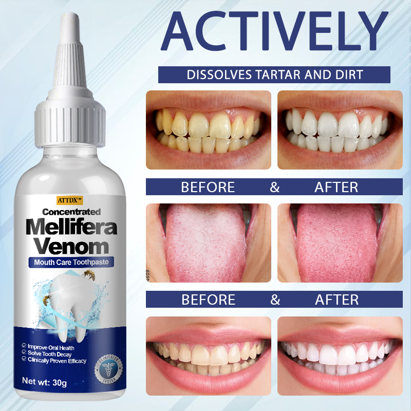 ATTDX™ Concentrated Mellifera Venom Mouth Care Toothpaste