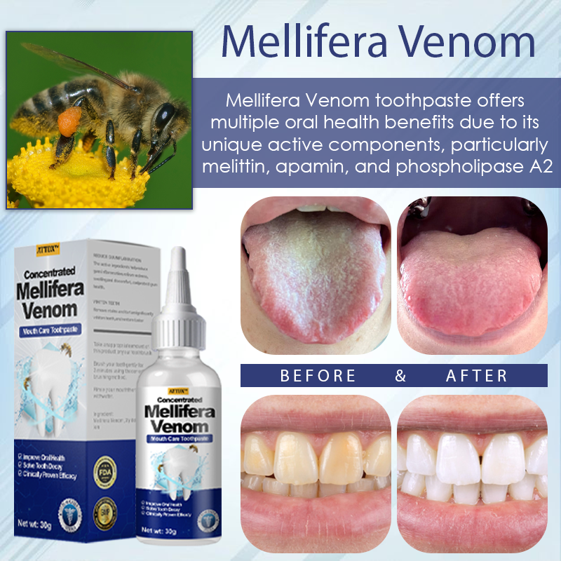 ATTDX™ Concentrated Mellifera Venom Mouth Care Toothpaste