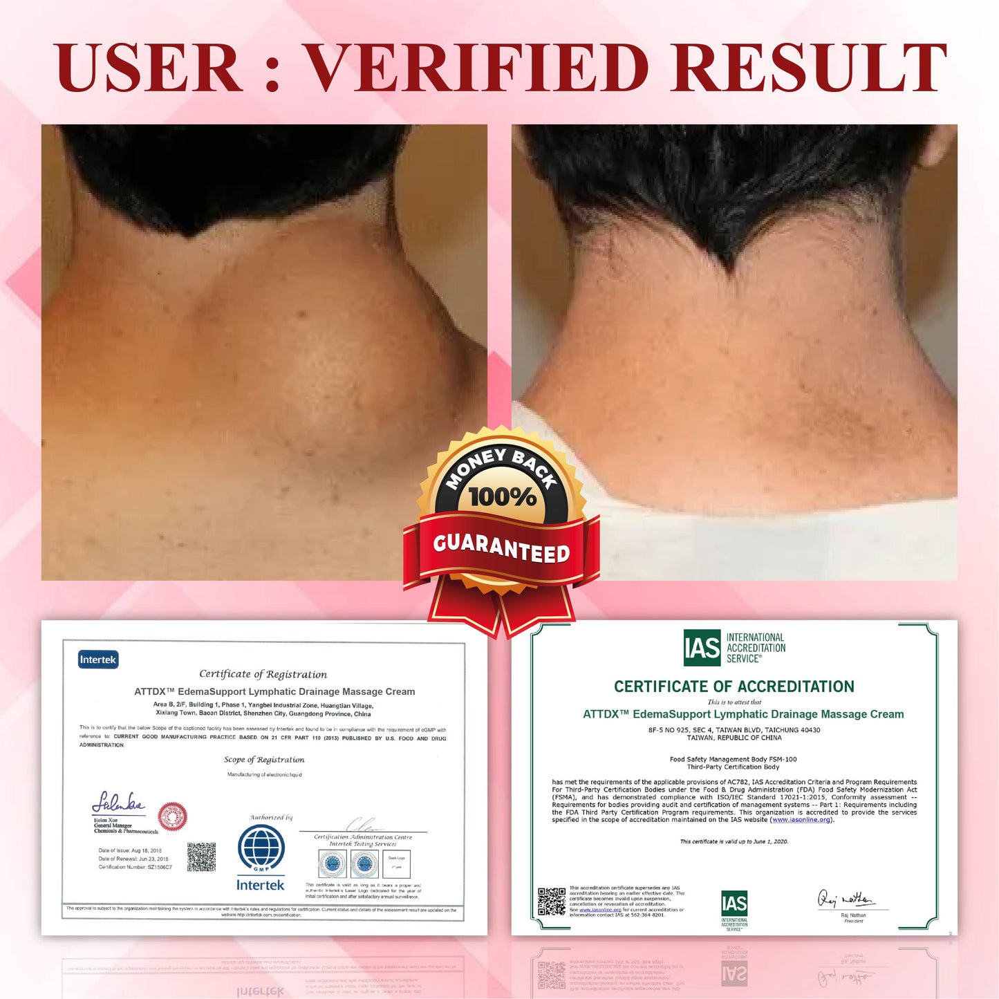 ATTDX™ EdemaSupport Lymphatic Drainage Massage Cream 2
