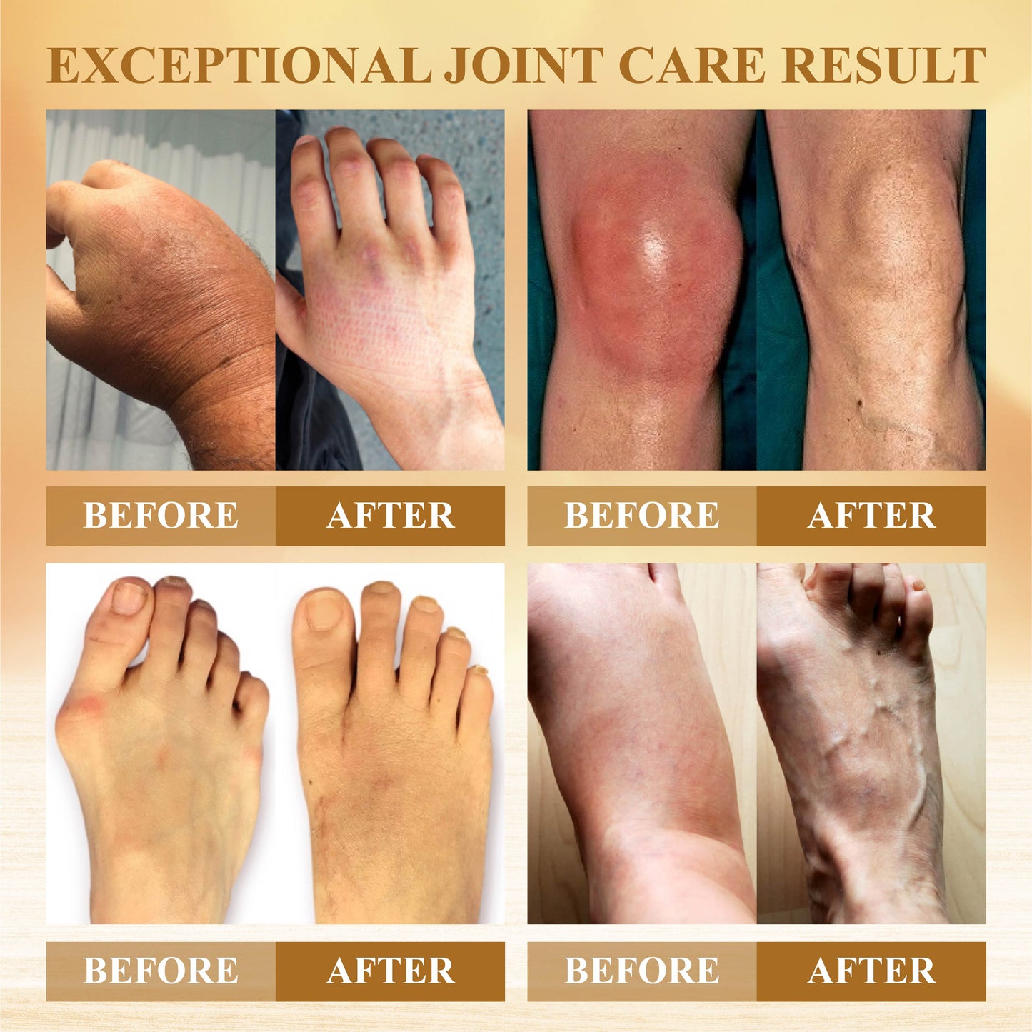 ATTDX™ Joint Soothe Mellifera Venom Bar