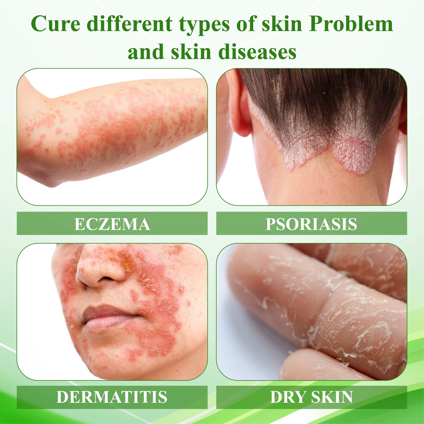 ATTDX™ Resurrection Grass Skin Soothing Herbal Cream