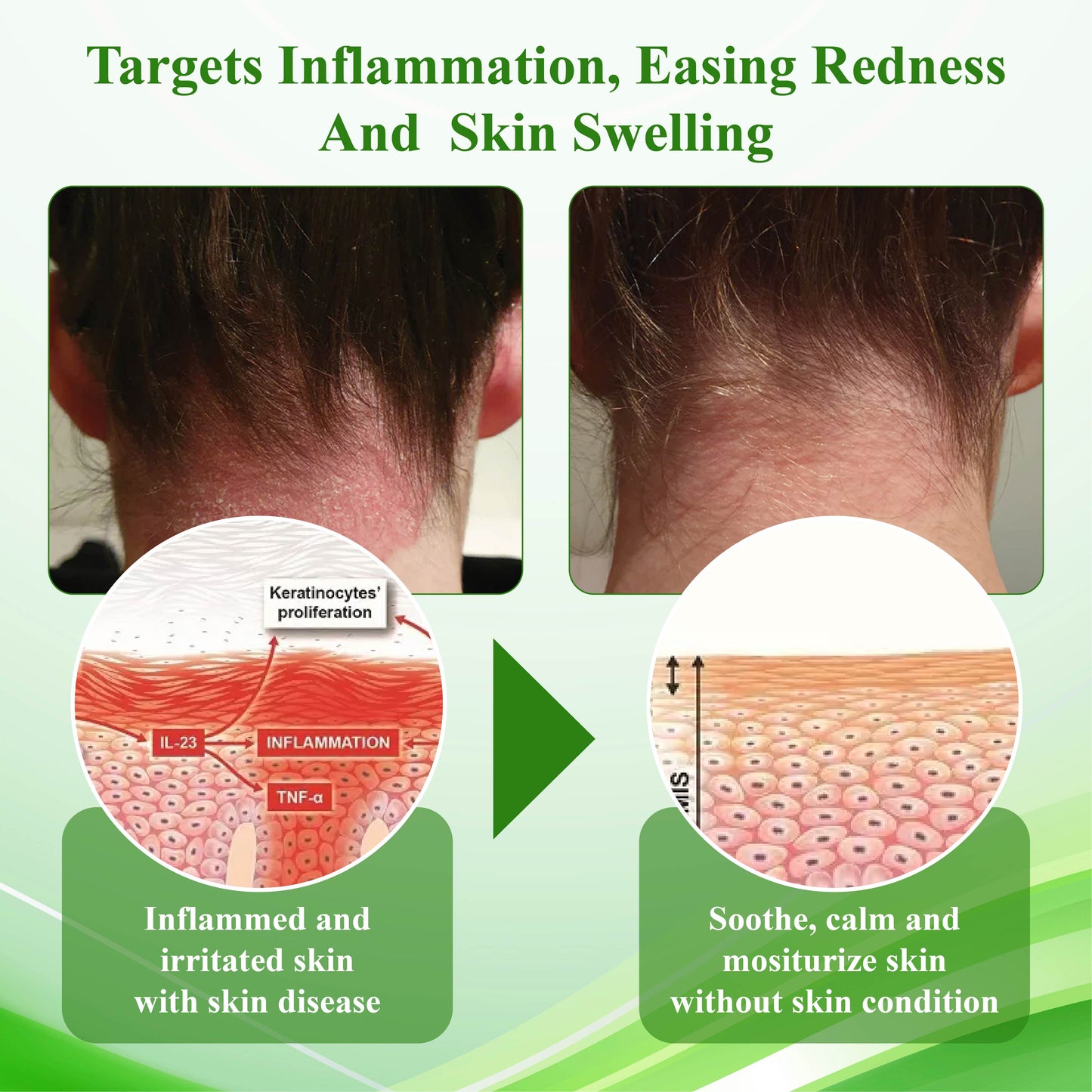 ATTDX™ Resurrection Grass Skin Soothing Herbal Cream