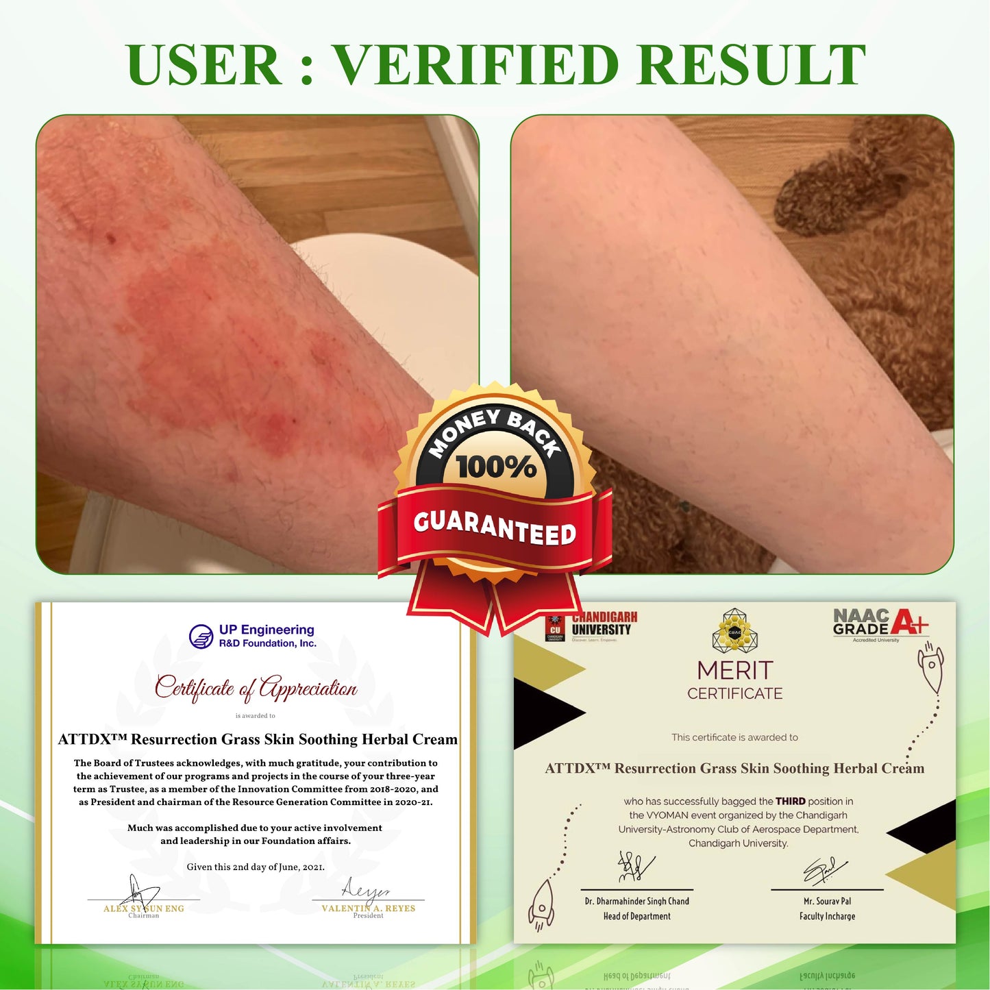 ATTDX™ Resurrection Grass Skin Soothing Herbal Cream