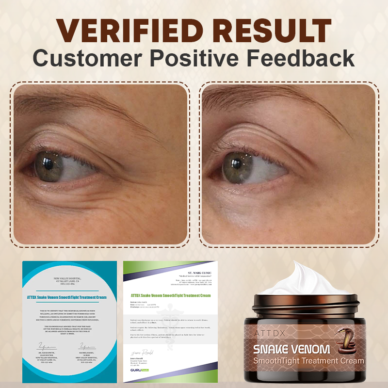 Snake Venom SmoothTight Treatment Cream