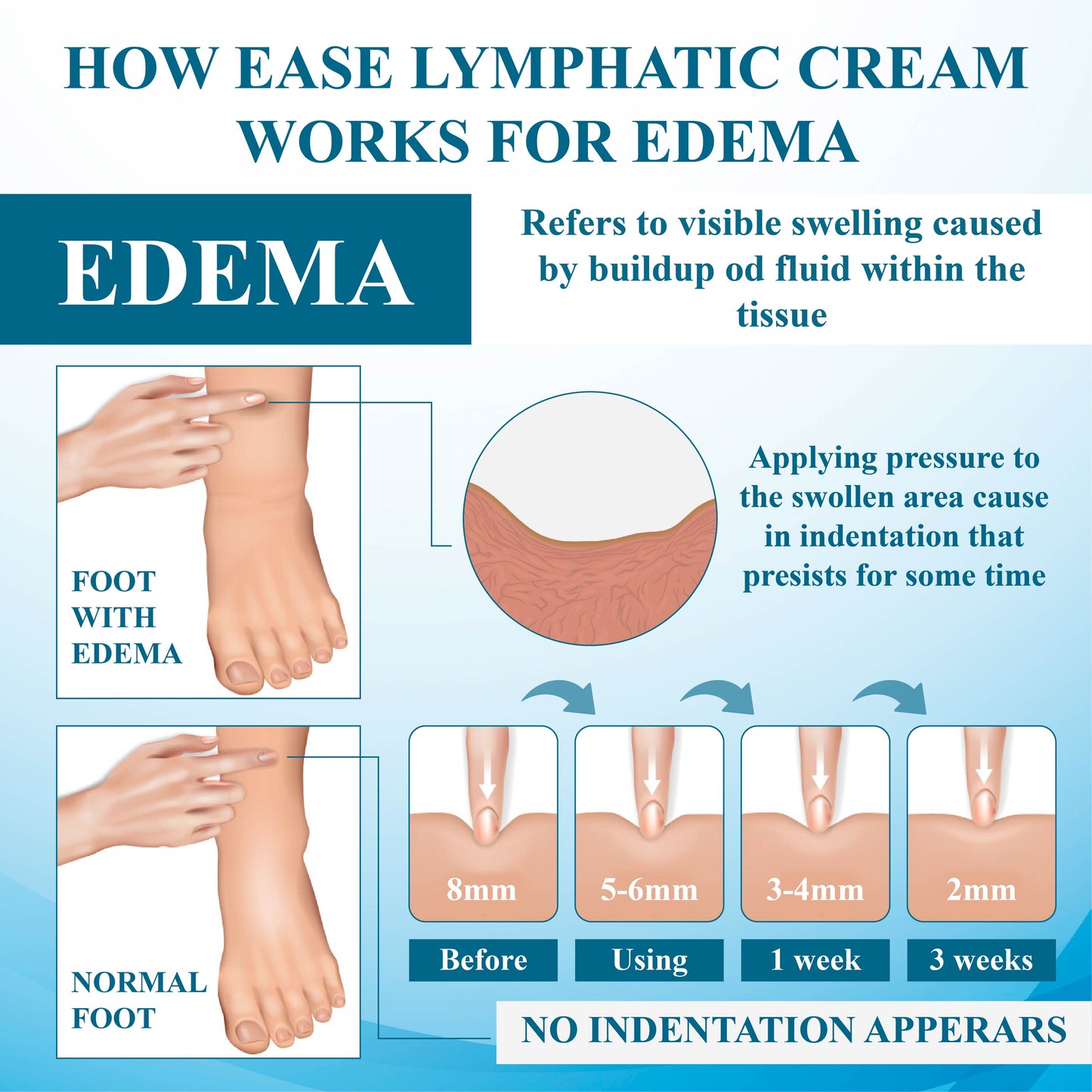 ATTDX™ SwellingEase Lymphatic Drainage Massage Cream