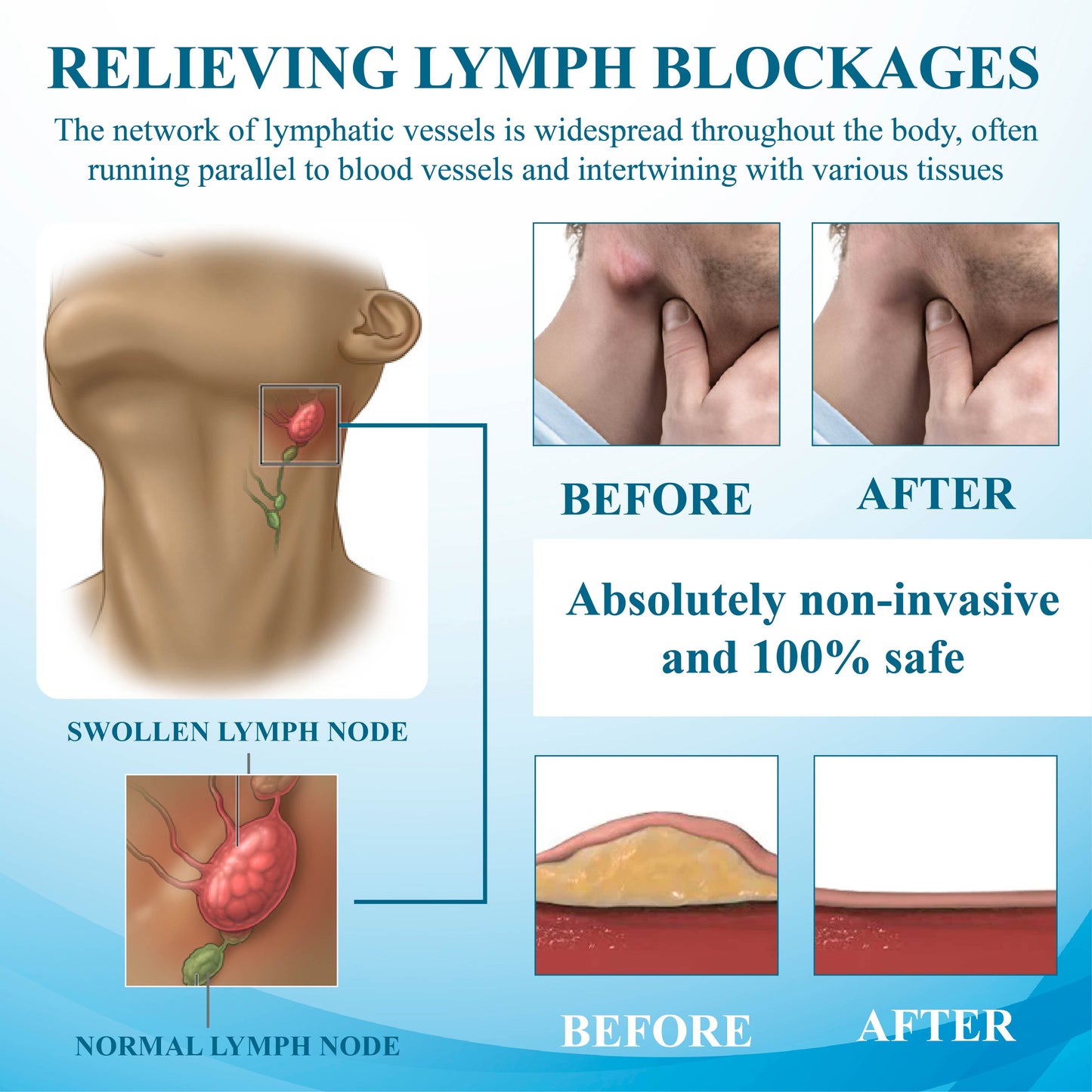 ATTDX™ SwellingEase Lymphatic Drainage Massage Cream