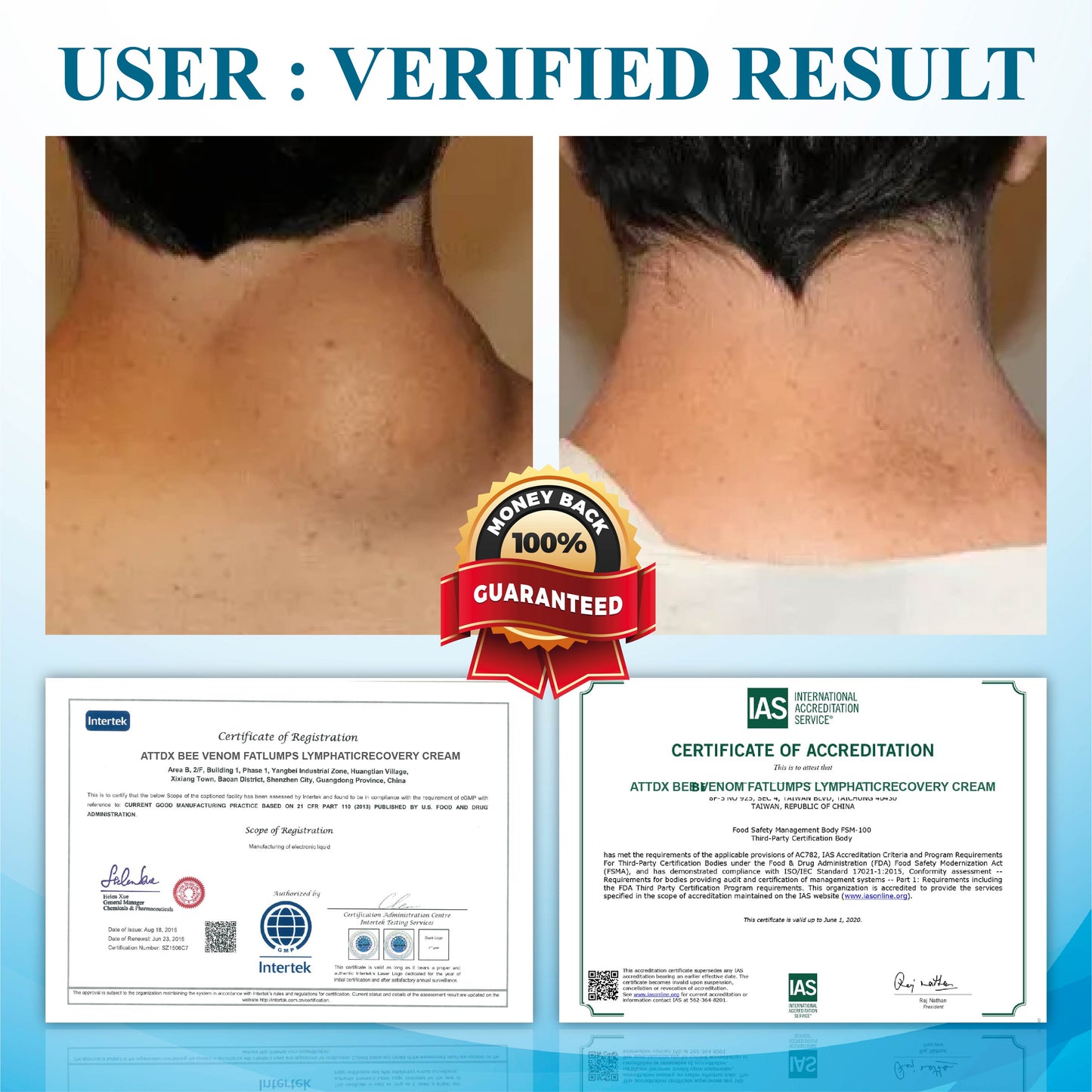 ATTDX™ SwellingEase Lymphatic Drainage Massage Cream