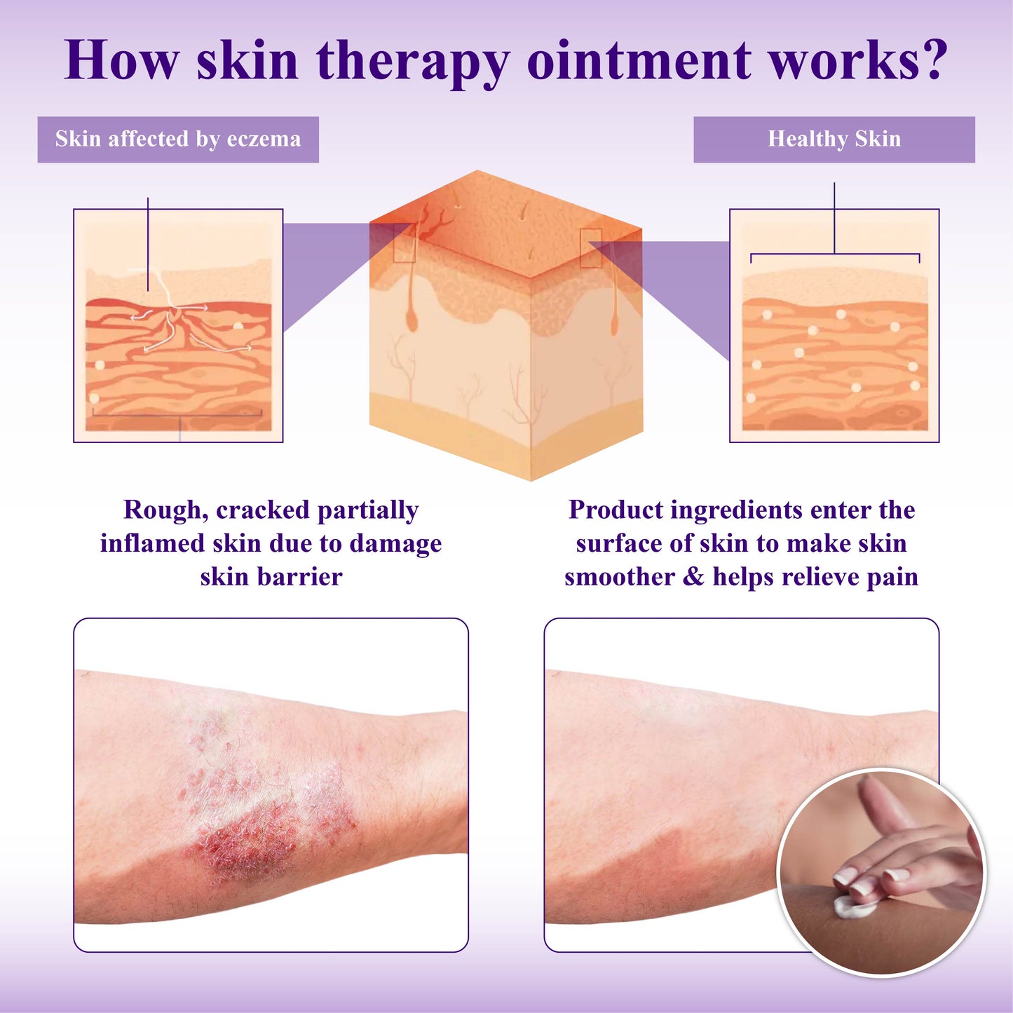 ATTDX™ Violet Soothing Skin Therapy Ointment