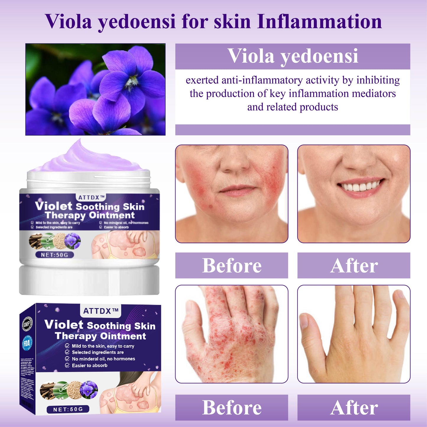 ATTDX™ Violet Soothing Skin Therapy Ointment