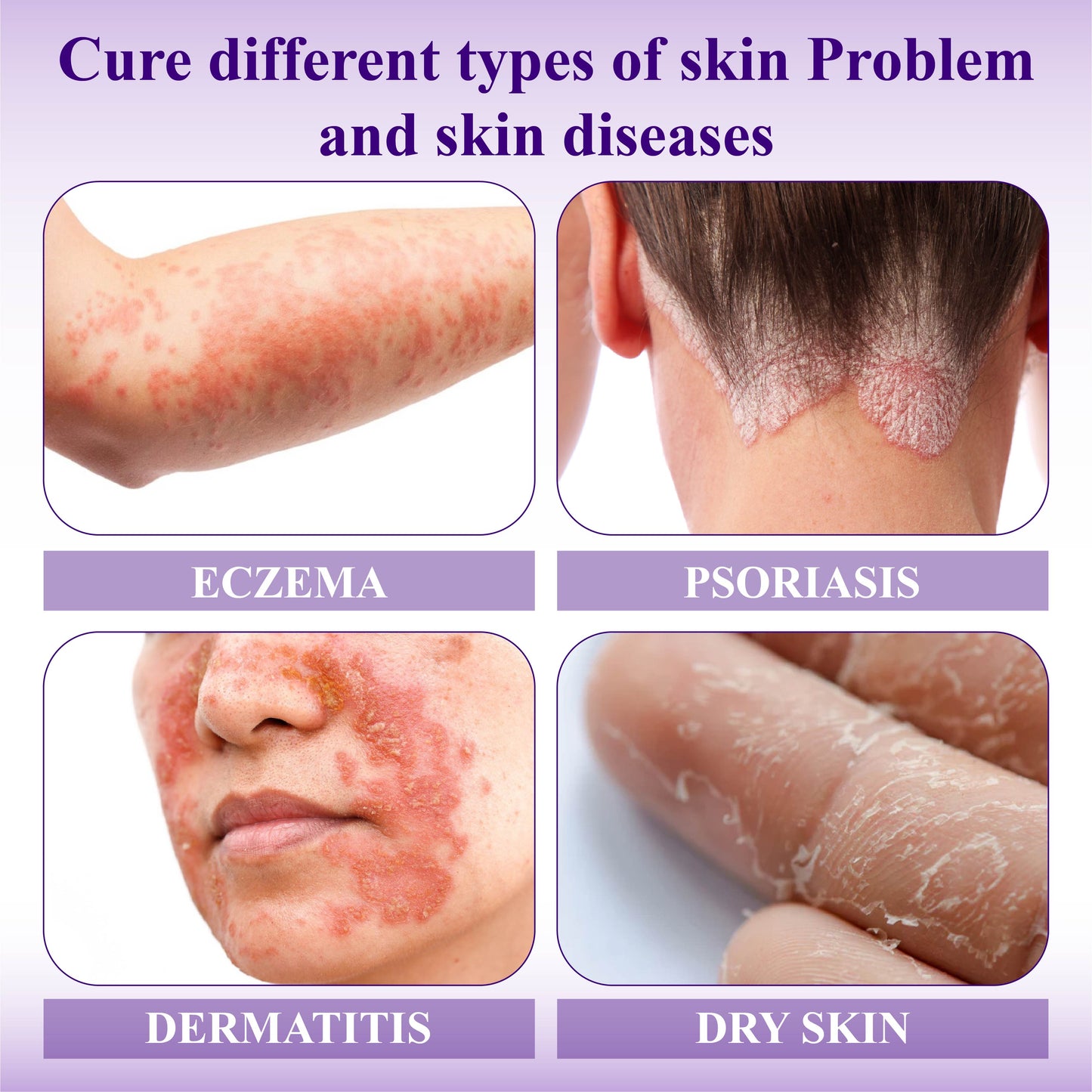 ATTDX™ Violet Soothing Skin Therapy Ointment