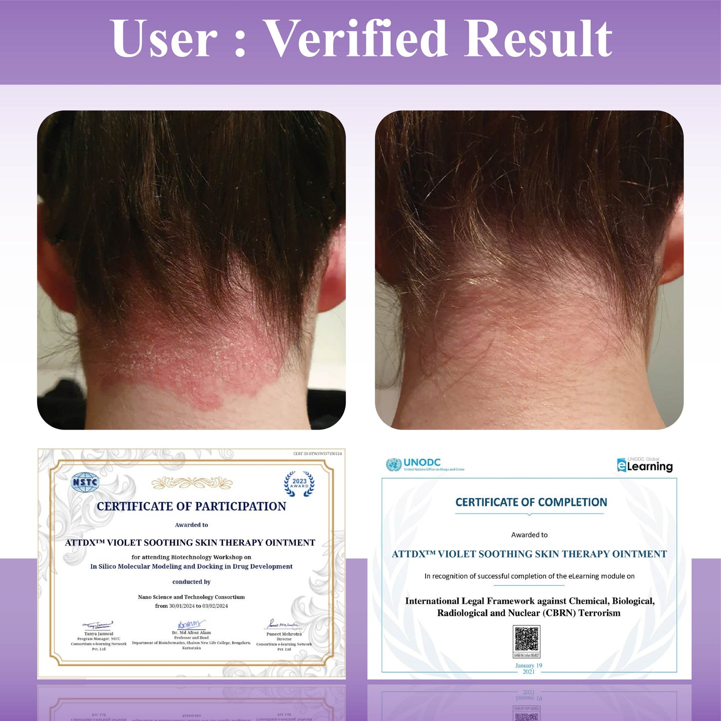 ATTDX™ Violet Soothing Skin Therapy Ointment