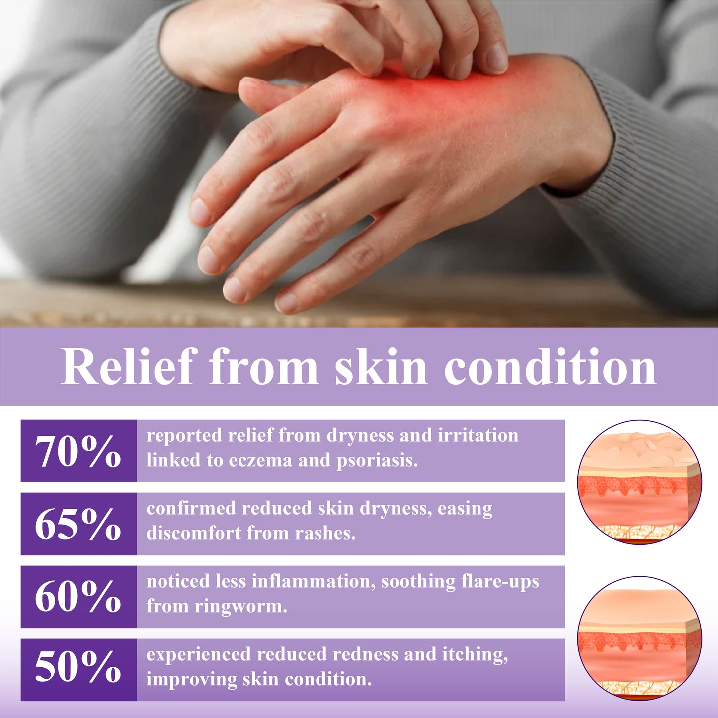 ATTDX™ Violet Soothing Skin Therapy Ointment