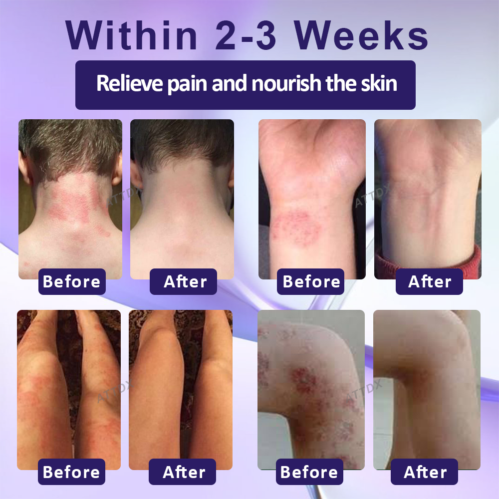 ATTDX™ Violet Soothing Skin Therapy Ointment