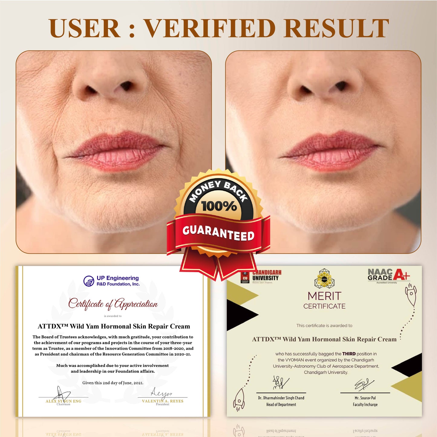 ATTDX™ Wild Yam Hormonal Skin Repair Cream