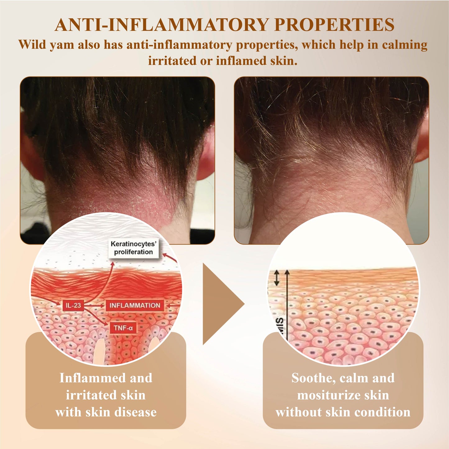 ATTDX™ Wild Yam Hormonal Skin Repair Cream