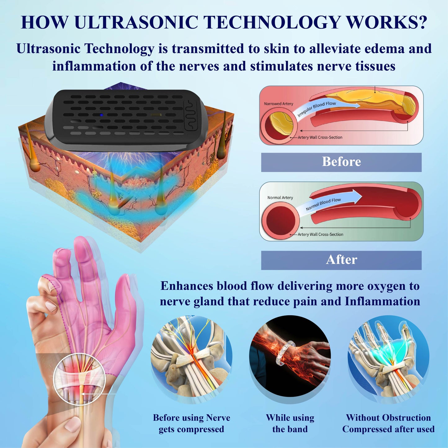 CircuWave™ Vein Support UltrasonicBand
