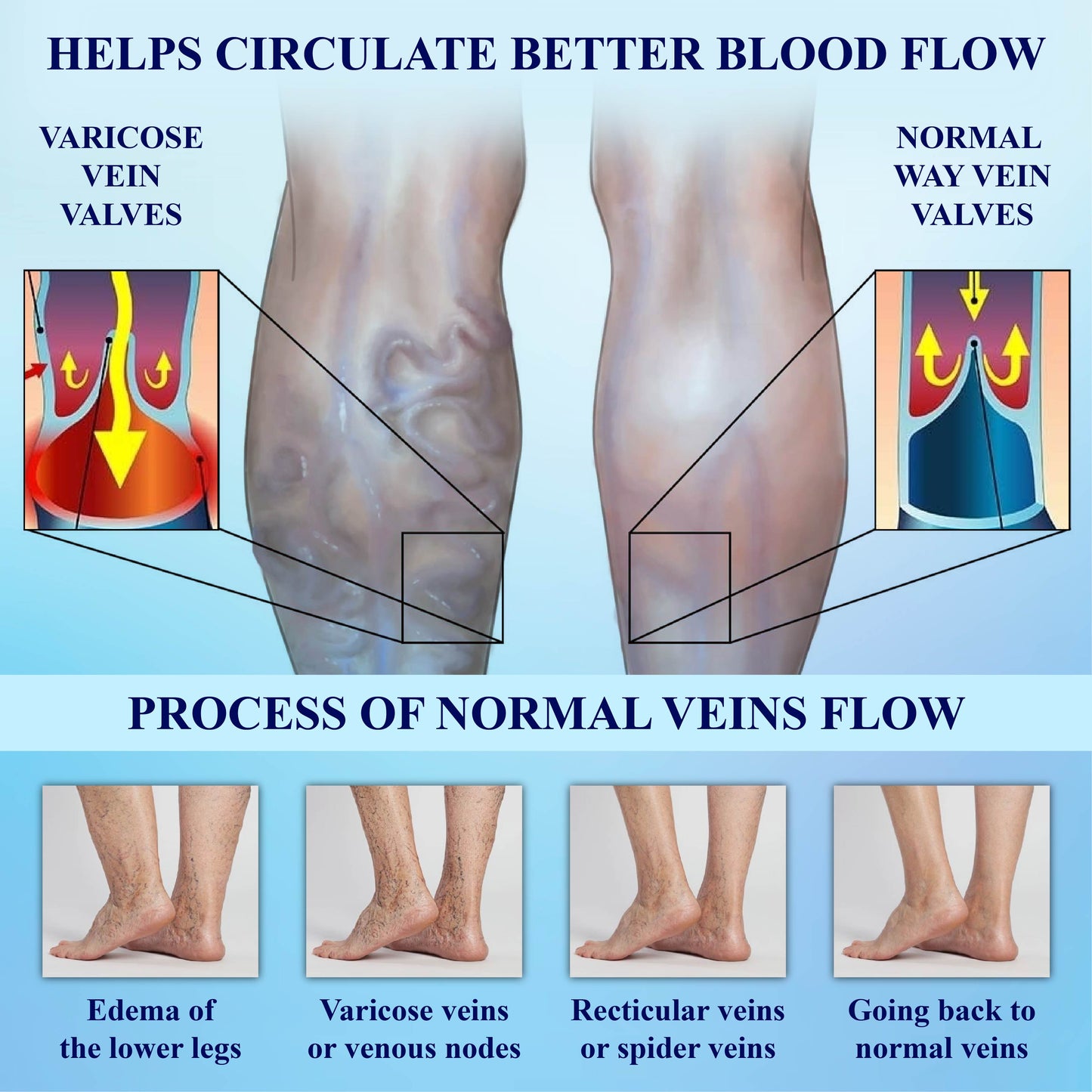 CircuWave™ Vein Support UltrasonicBand