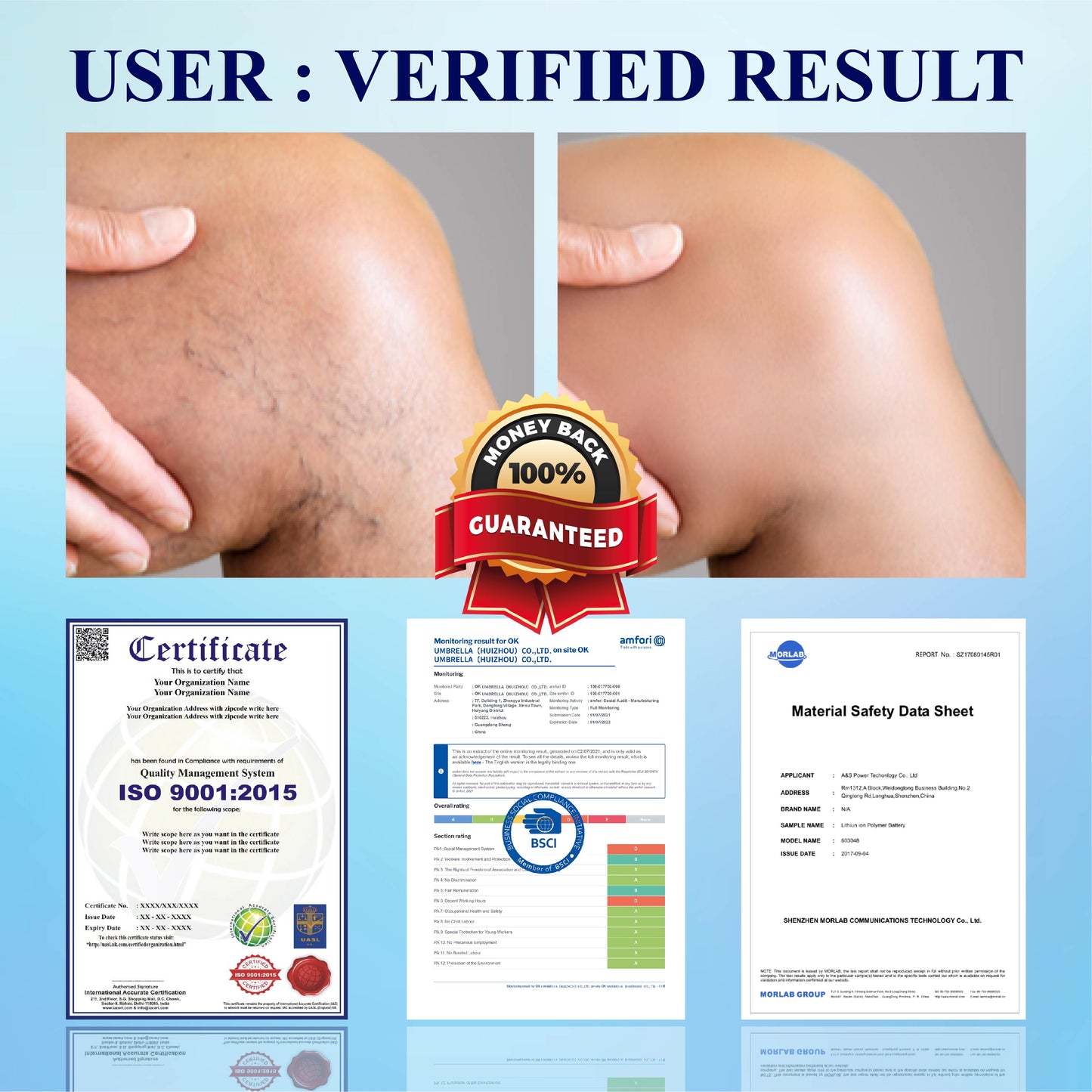 CircuWave™ Vein Support UltrasonicBand
