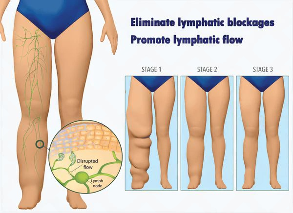 DetoxFlow⢠Portable LymphaticDetox And Joint Relaxation Therapy Device