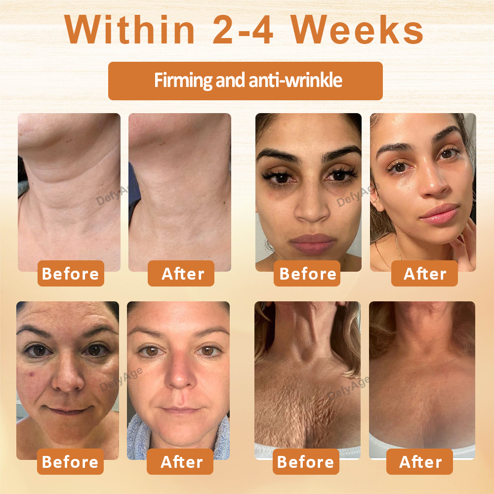 DefyAge™ ApiSculpt BotoxAging Cream