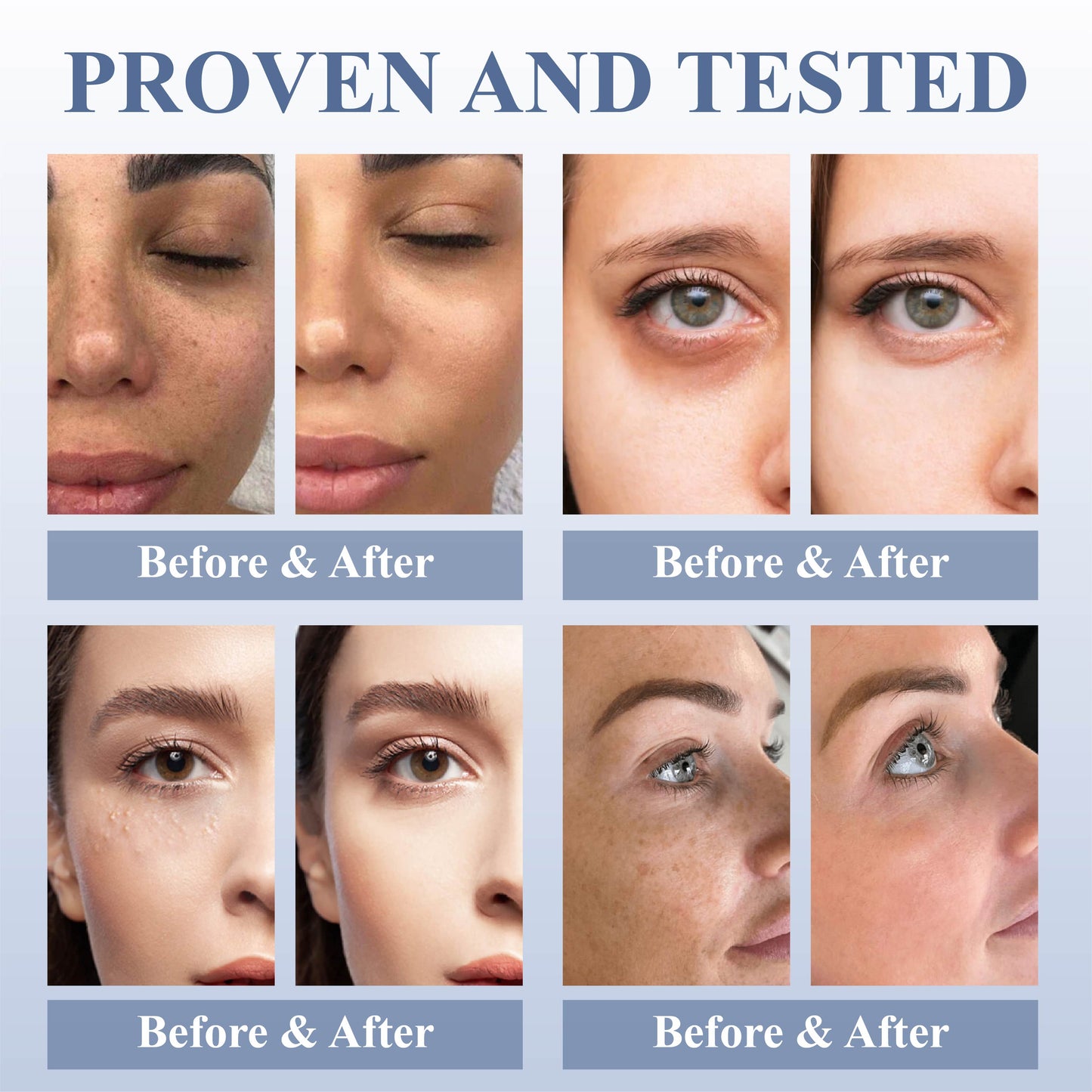 DefyAge™ EyeRepair Treatment Cream