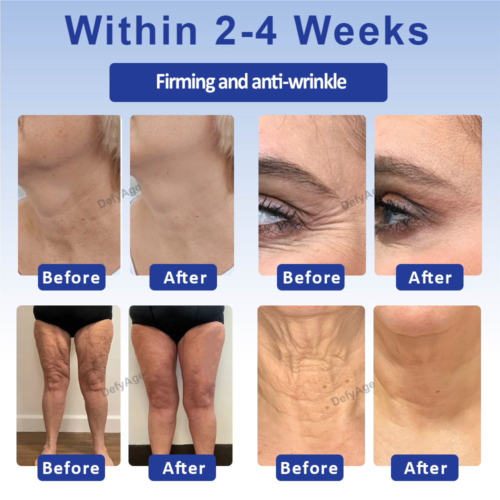 DefyAge™ WrinklesErase Roll On FirmingCream