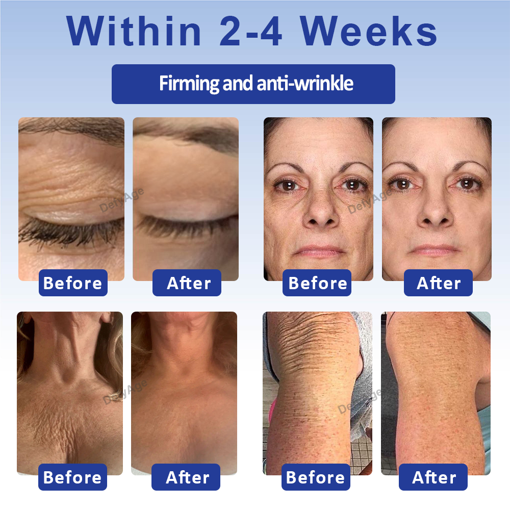 DefyAge™ WrinklesErase Roll On FirmingCream