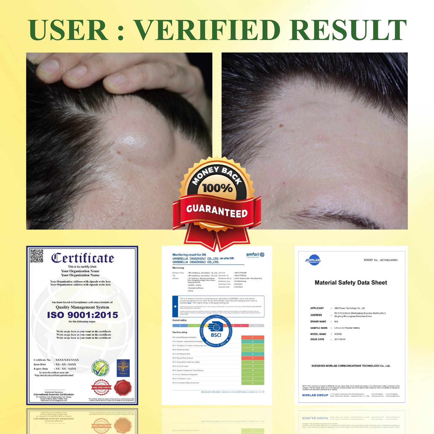 DetoxFlow™ Lymphatic Support SwellingEase Oil