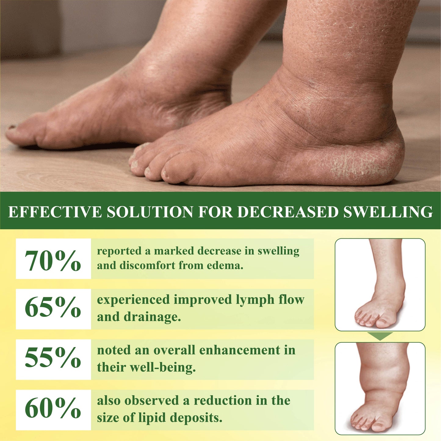 DetoxFlow™ Lymphatic Support SwellingEase Oil