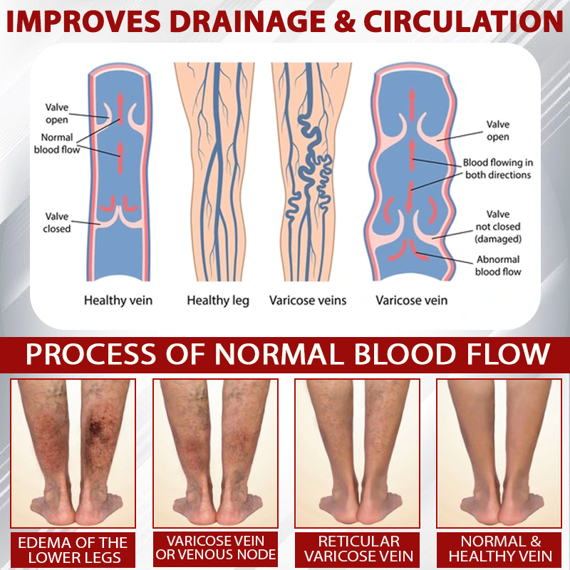 ATTDX® Red Vine FluidRelief Edema Gel