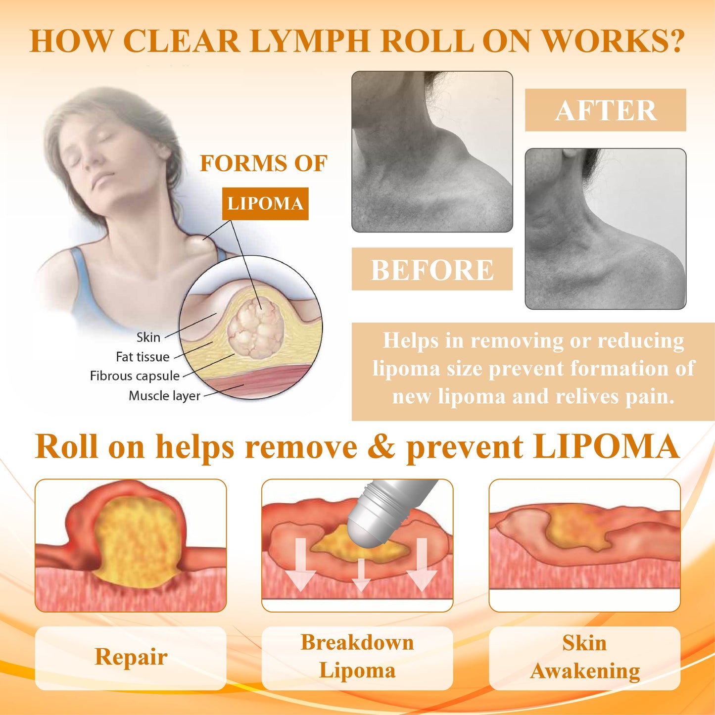 LumpFix™ Apis Venom LymphSupport Roll On