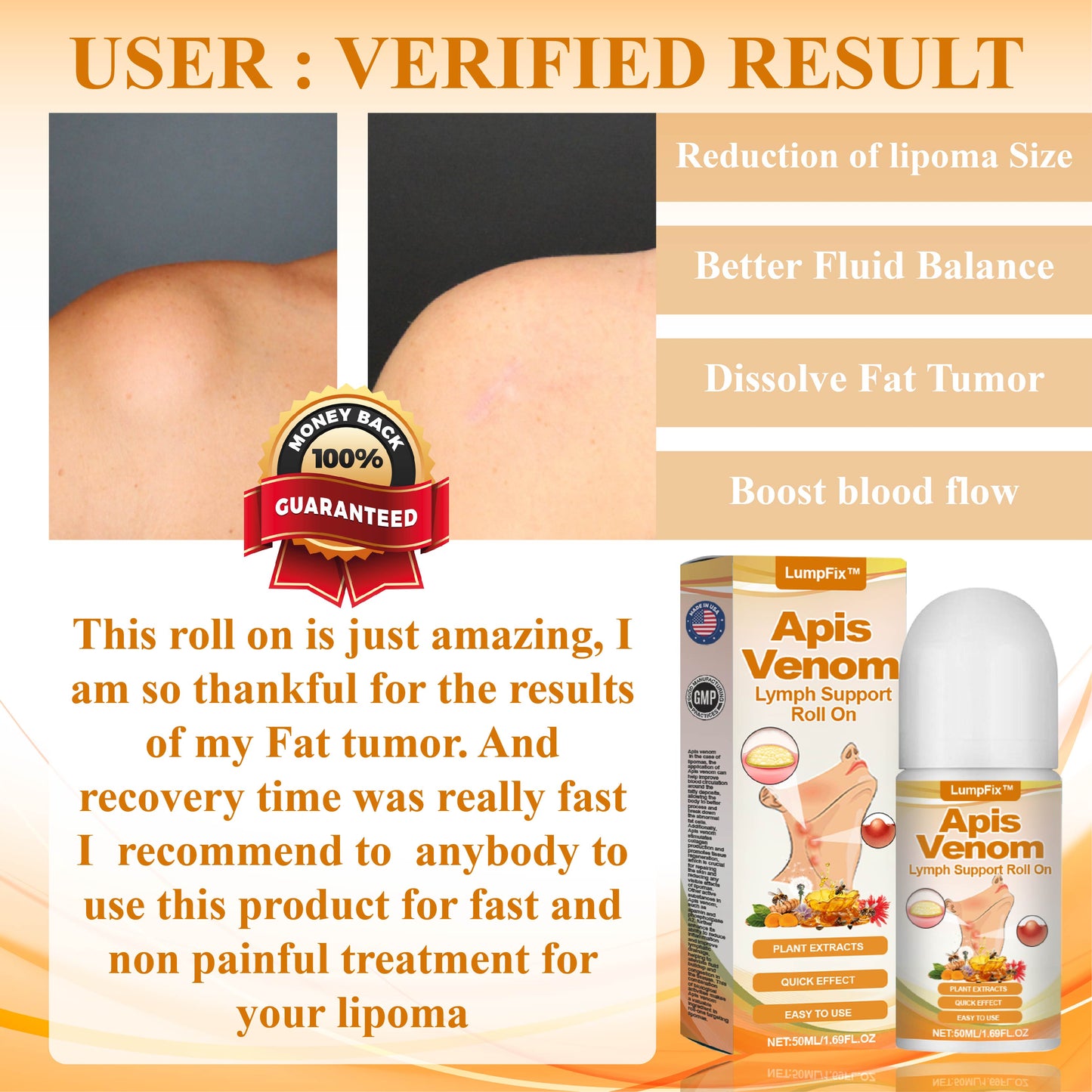 LumpFix™ Apis Venom LymphSupport Roll On