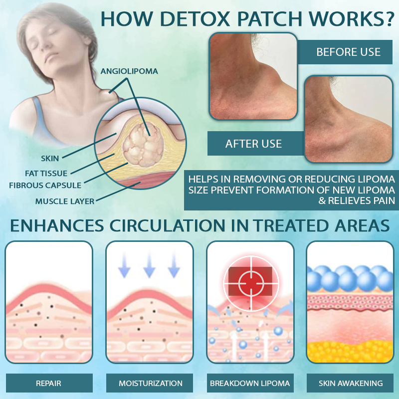 LumpFix™ Circulation Support DetoxPatch
