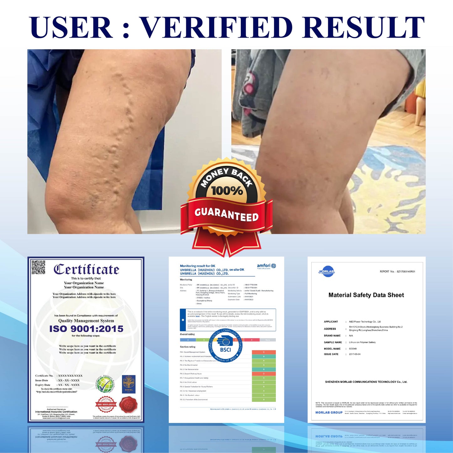 NerviEase™ Ultrasonic Circulation Band