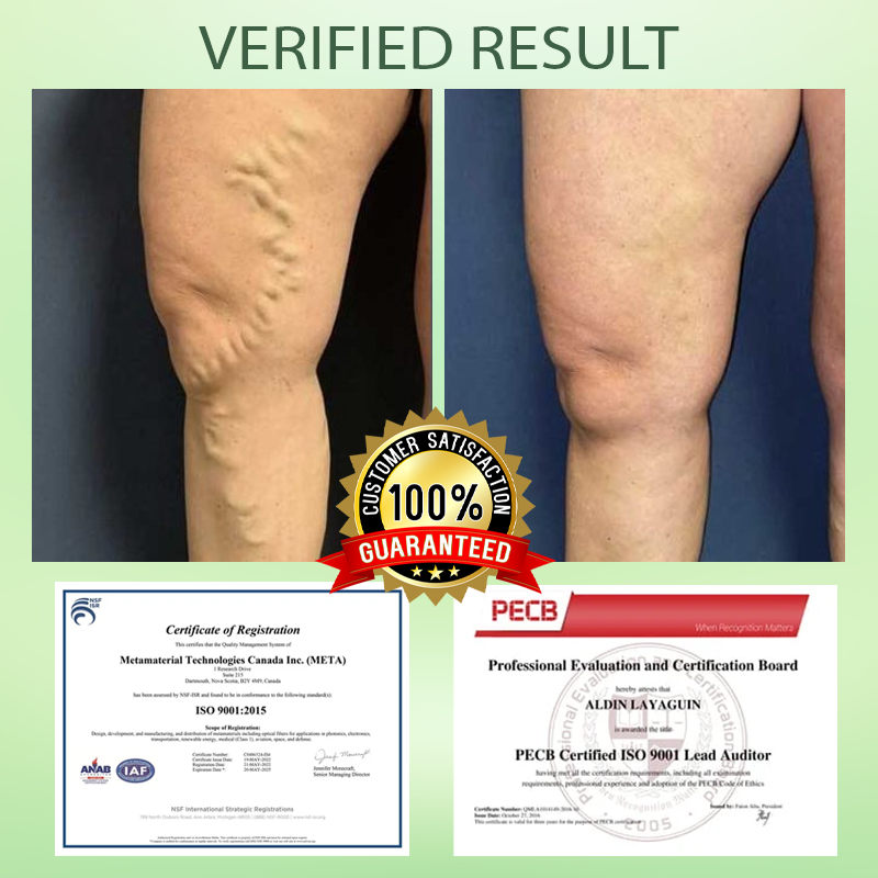 RICPIND™ Circulation Max Tourmaline Fiber Leg Sleeves