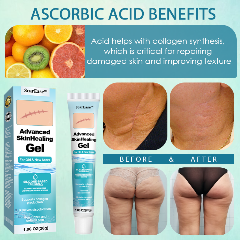 ScarEase™ Advanced SkinHealing Gel