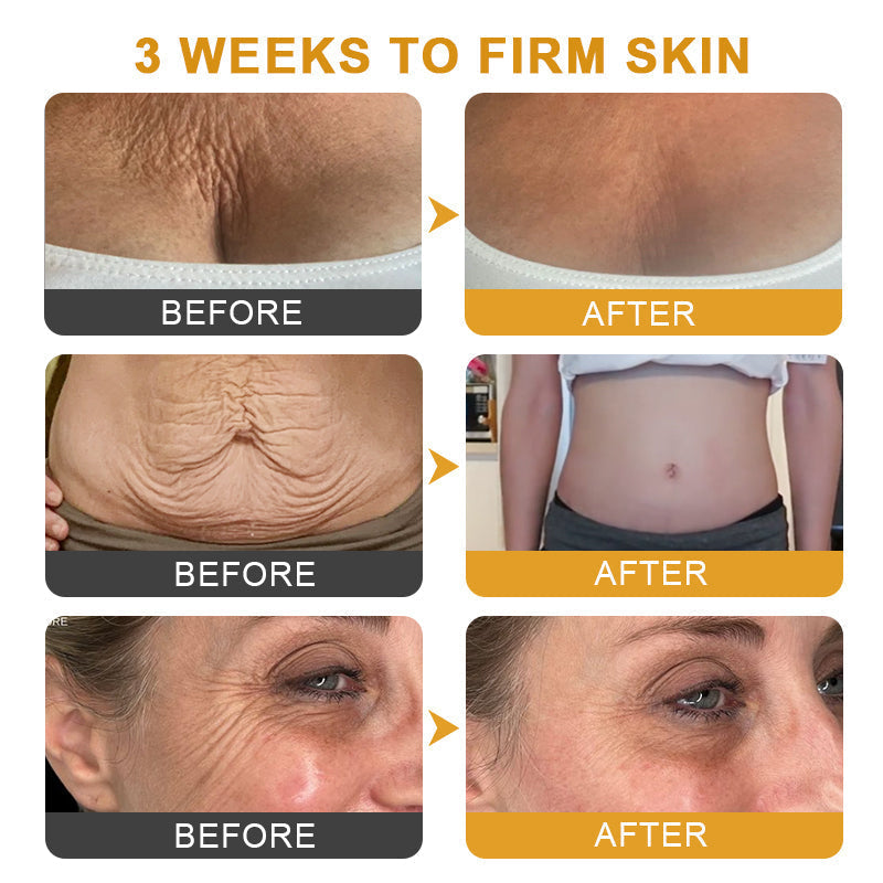 ApisDerm™ Botox BeeVenom WrinkleFirming Multi-Purpose Cream 3