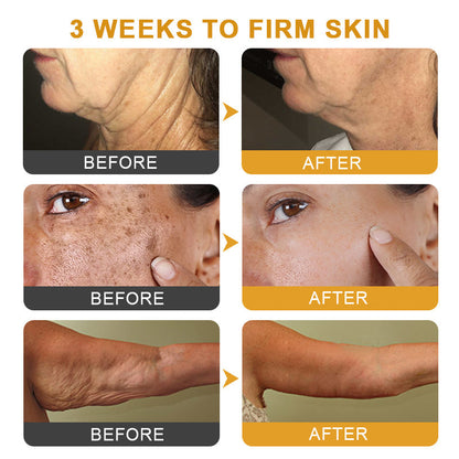ApisDerm™ Botox BeeVenom WrinkleFirming Multi-Purpose Cream 3