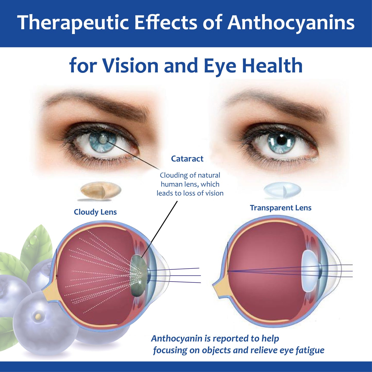 Vision RenewRestorative Eye Drops