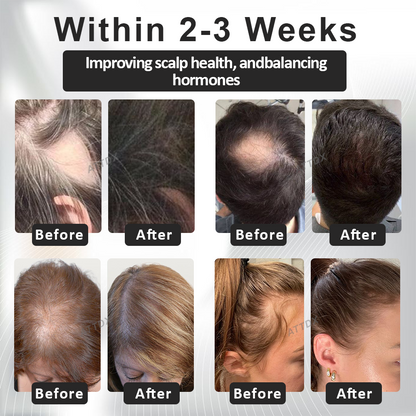 ATTDX™ Alopecia Recovery Hair Booster Roll-On