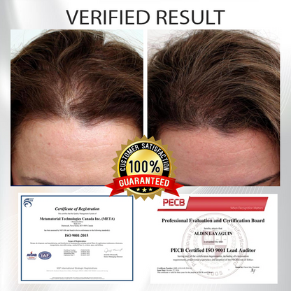 ATTDX™ Alopecia Recovery Hair Booster Roll-On