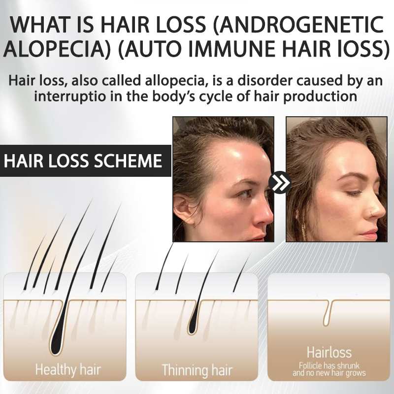 ATTDX™ Alopecia Recovery Hair Booster Roll-On