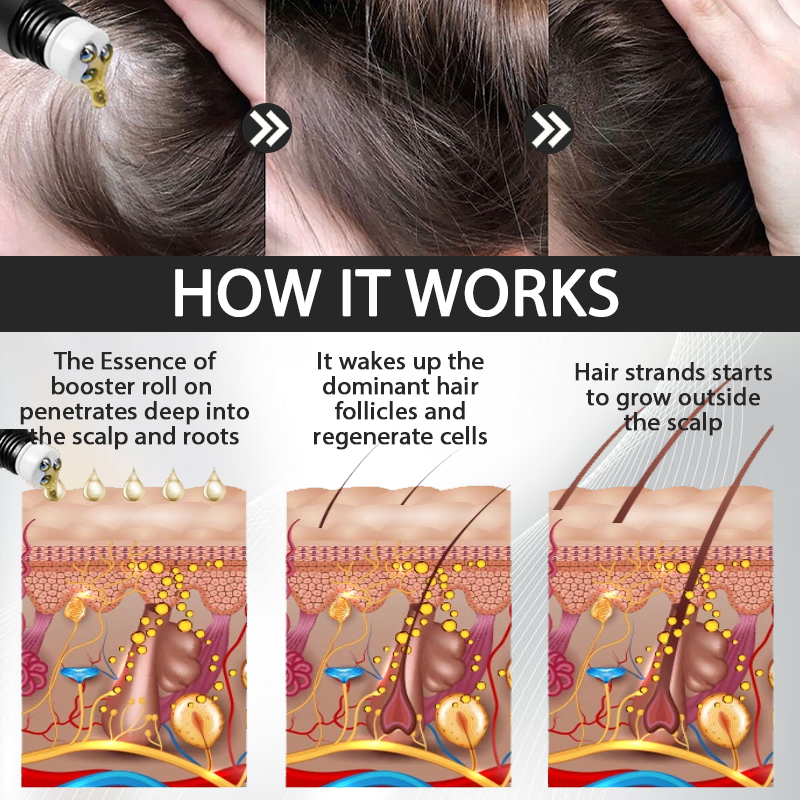 ATTDX™ Alopecia Recovery Hair Booster Roll-On