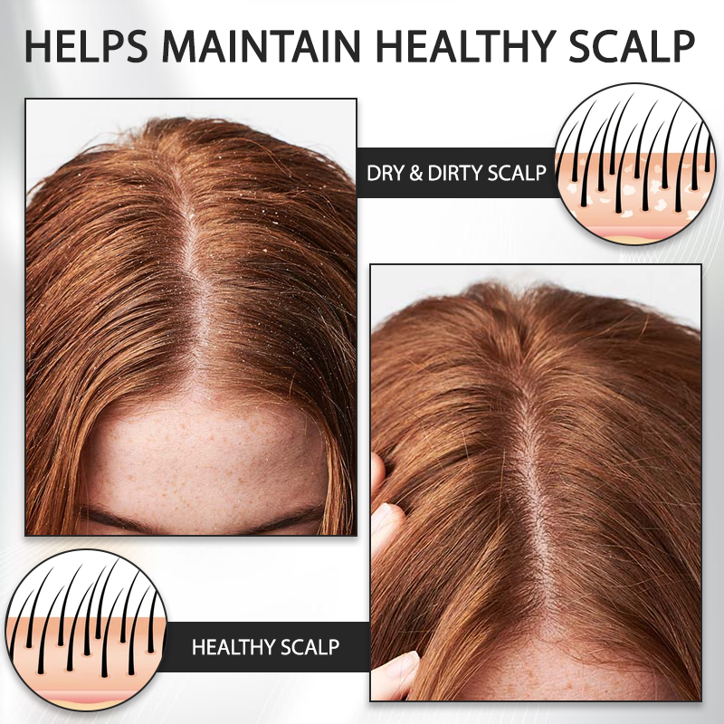 ATTDX™ Alopecia Recovery Hair Booster Roll-On